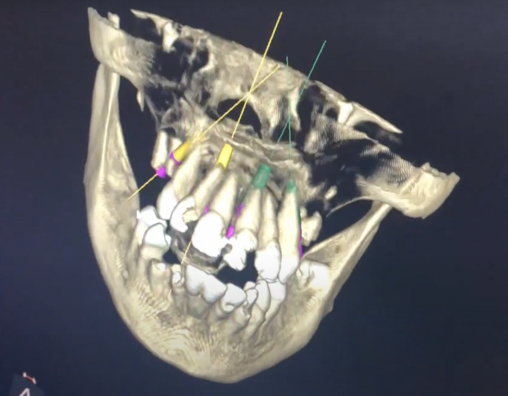 How Do I Know If I Need A Ct Scan